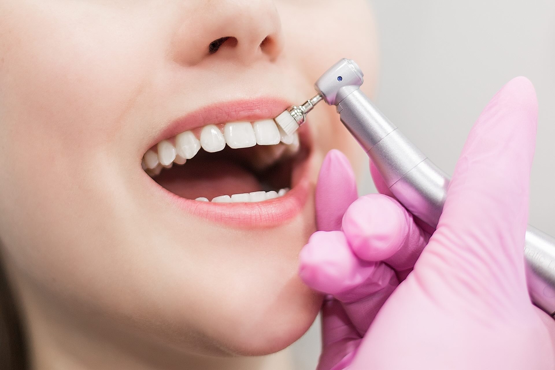 dentist-office-8 Blanqueamiento dental